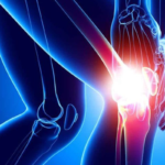 Joint Pain Ayurveda Treatment
